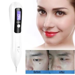 Spot Removal Machine Mole Freckle Spot Tattoo